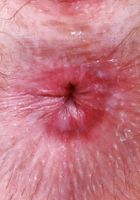 ATK Natural & Hairy: Big Eyes (Big Eyes might be a cow)