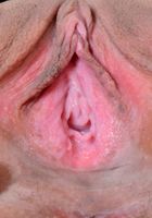 Ember Stone in amateur, Ember Stone (emb005) ATK Galleria: Ember Stone (Ember Stone in amateur)