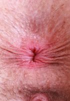 ATK Galleria: Juniper Ren (Juniper Ren Stockings Panties and Pussy Spreads)