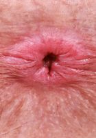 Juniper Ren from ATK Galleria