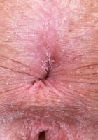 ATK Galleria: Lily Winters (Lily Winters is feeling cute and sassy)