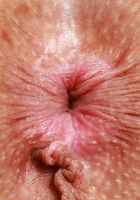 ATK Galleria: Ophelia Fae (Ophelia Fae Short Skirt Strip and Spreading)