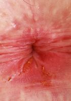 Stephanie Gwen Spreading Outdoors, Stephanie Gwen (ste079) ATK Petites: Stephanie Gwen (Stephanie Gwen Spreading Outdoors)
